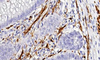 Reactivo de anticuerpos S100 (inmunohistoquímica)