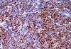 Reactivo Proteína Anticuerpo Proteína Ciclina D1 (Inmunohistoquímica)