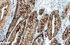 Reactivo de anticuerpo del antígeno carcinoembrionario (CEA) (inmunohistoquímica)