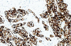 Reactivo de anticuerpos de citoqueratina (amplio espectro) (inmunohistoquímica)